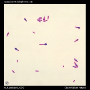 clostridium tetani endospores